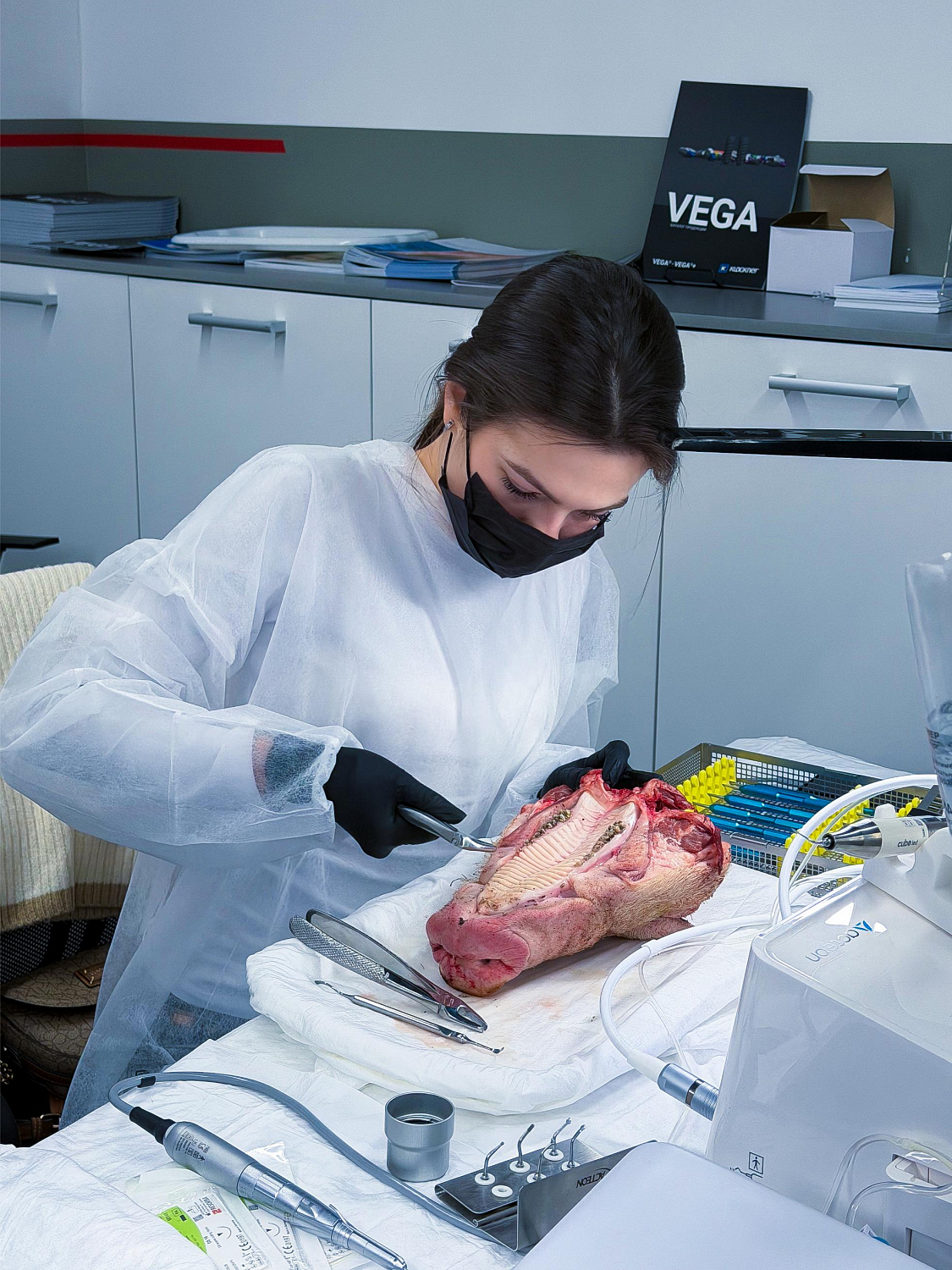 Удалить зуб и сохранить лунку: как проходит малотравматичная хирургия  