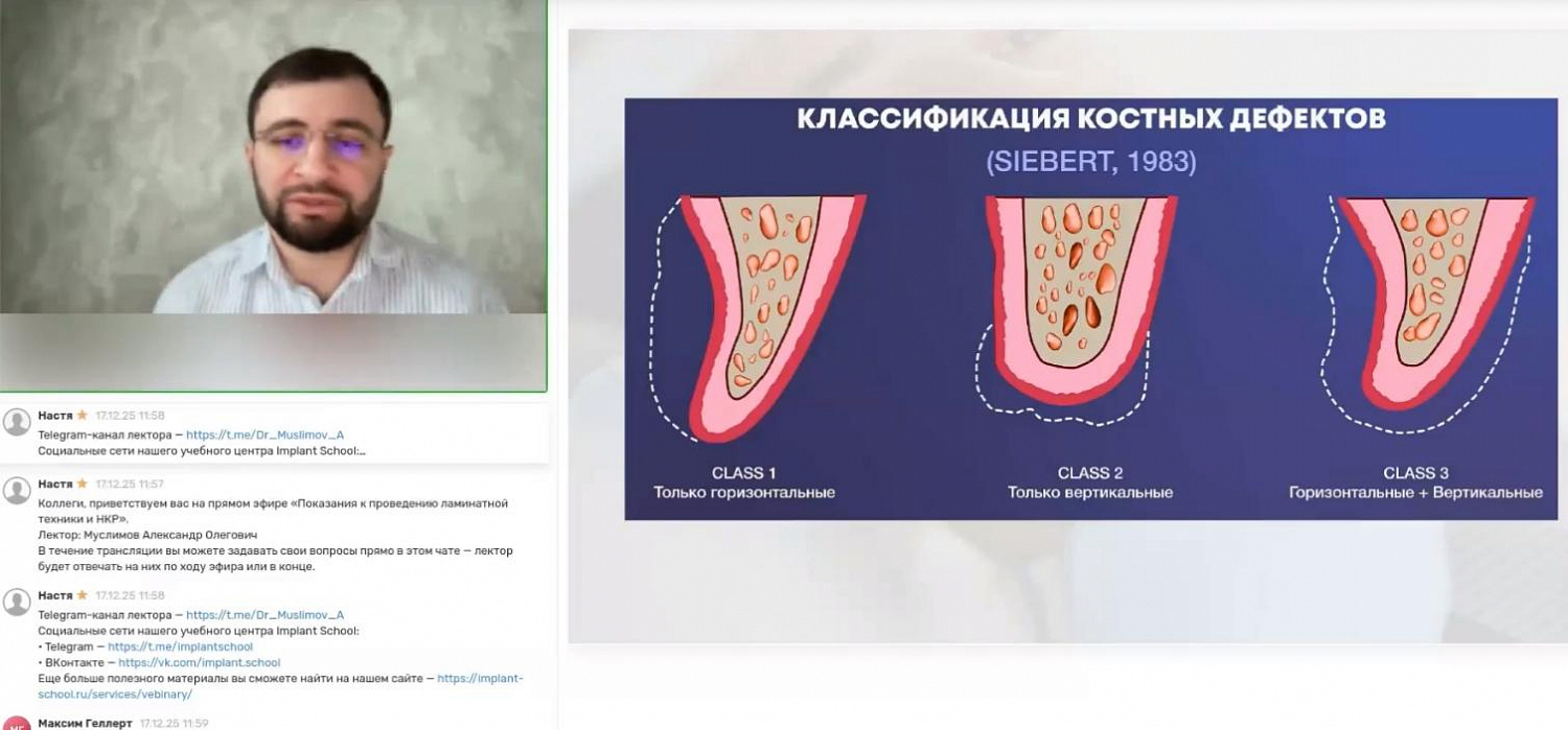 Показания к проведению ламинатной техники и НКР