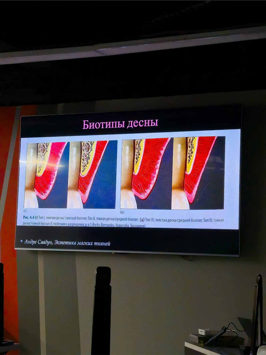 Эстетика начинается с десны: курс по пластике мягких тканей