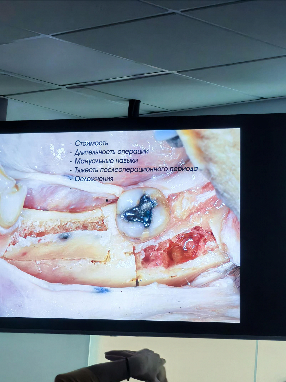 Два дня глубокой практики по костной пластике и синус-лифтингу