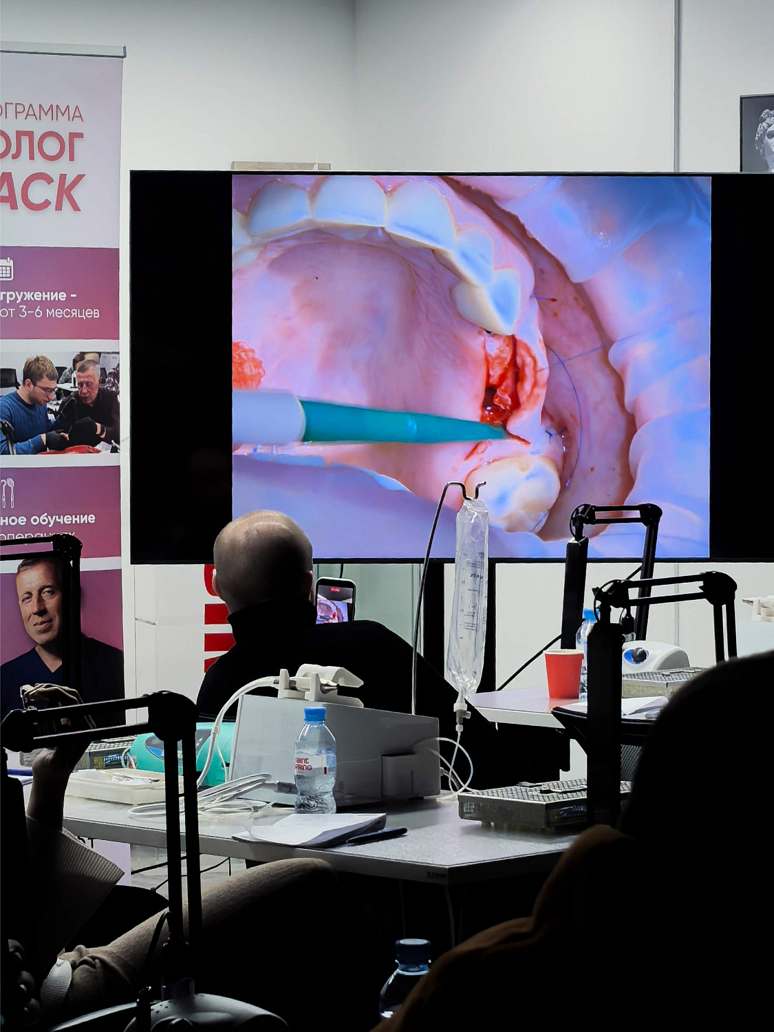 Эстетика начинается с десны: курс по пластике мягких тканей