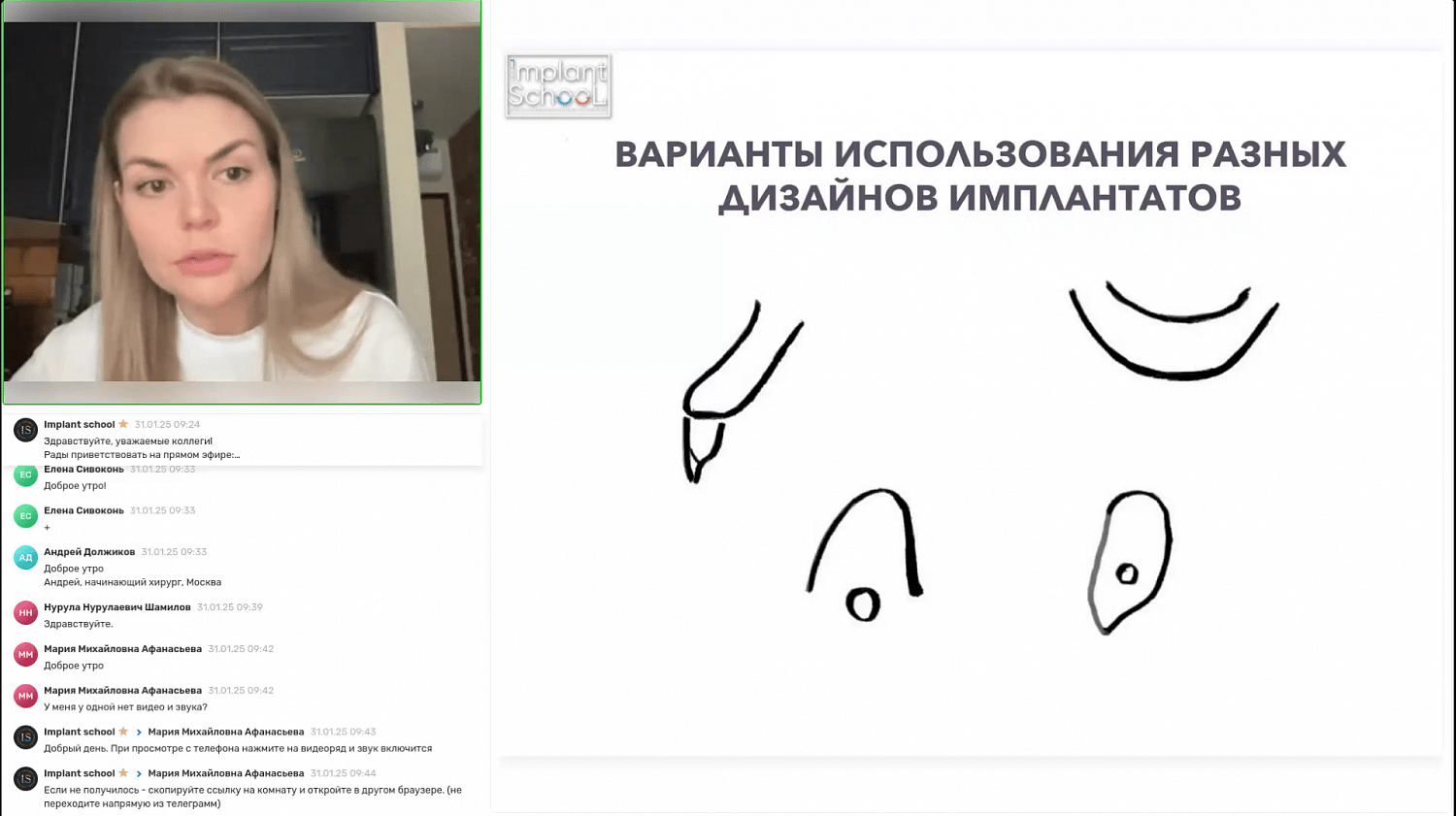 Выбор имплантата, диагностика и планирование имплантационного лечения